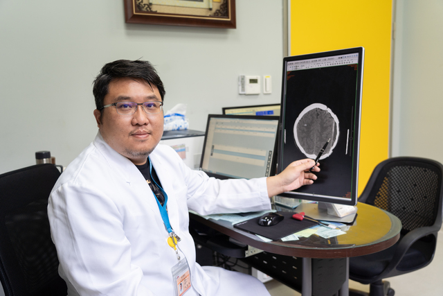 前額痘痘狂流膿 就醫赫見「頭蓋骨曝露」