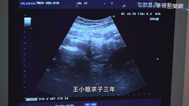 七對夫妻一對不孕! 搶救生育率難題