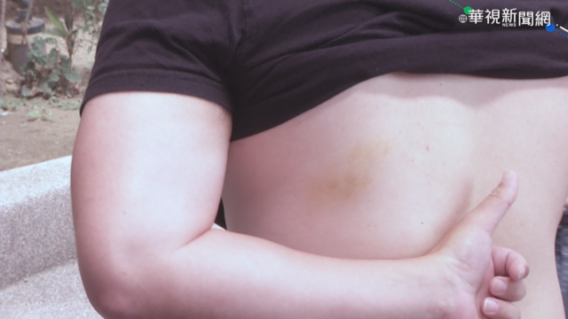 被嗆看門狗 工廠保全持棍毆外送員