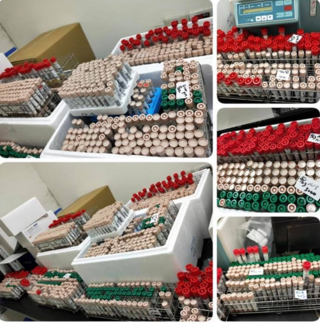 因「檢體塞車」要校正回歸 醫檢師曝「CDC網站卡」：可改善嗎？