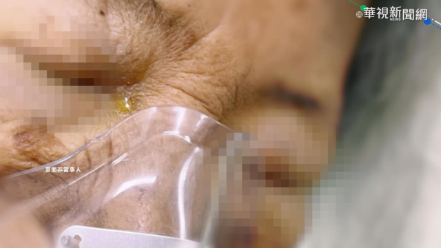 醫師幫蓋被! 離世癌末婦眼角滲淚..