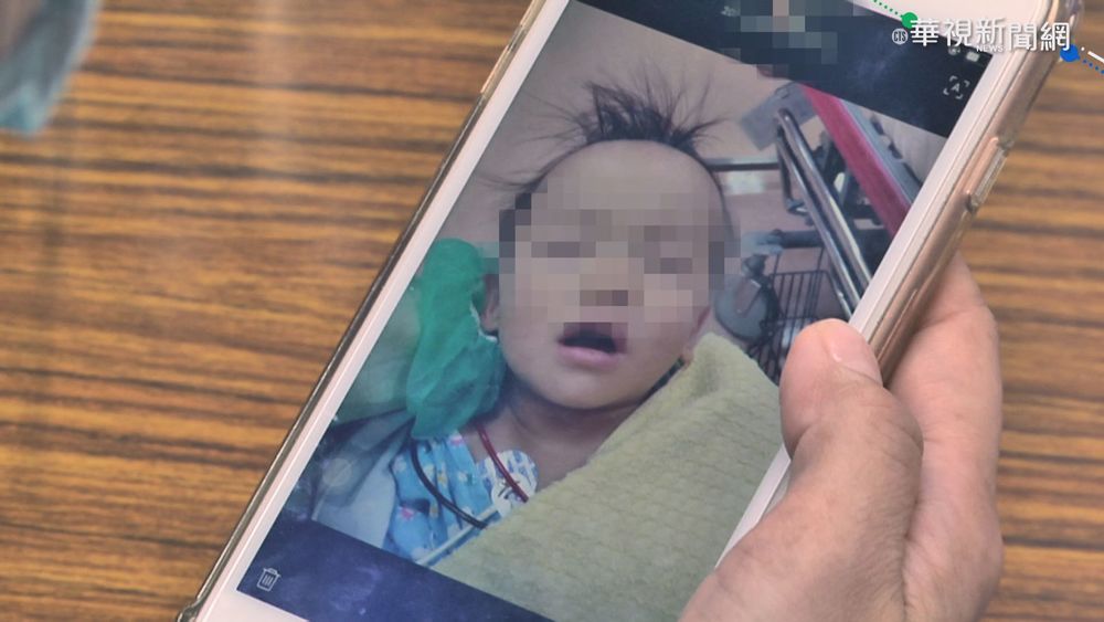 1歲兒手術無法陪 醫檢師忍淚上工