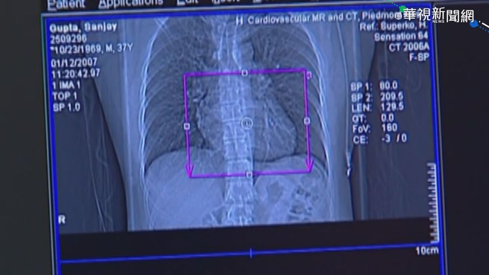美:輝瑞.莫德納 恐與罕見心臟發炎有關