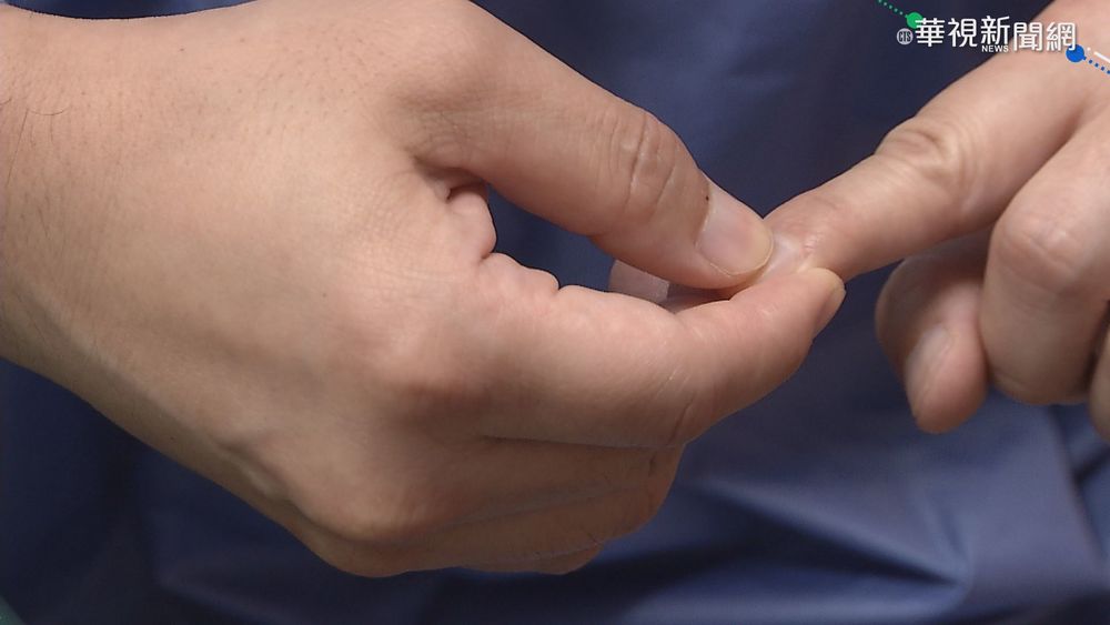 自我檢測血氧濃度 壓指甲面也能觀察!