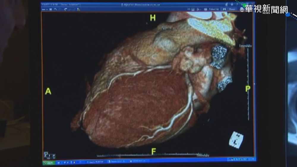13歲少年打BNT後猝死 美CDC追查