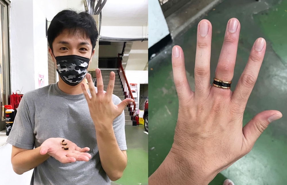 5萬名牌戒卡死！男星中指腫成「墨魚香腸」急衝消防局剪斷