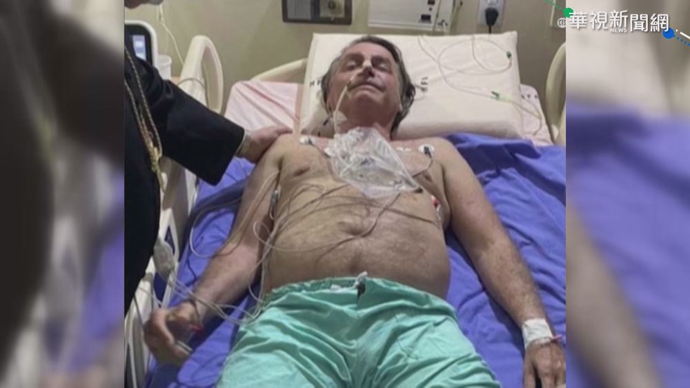 不明原因打嗝 巴西總統波索納洛住院