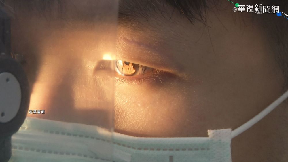 防疫宅家追劇.打電動 眼科門診暴增2成