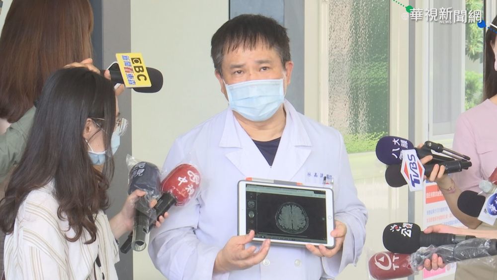 腦傷損記憶力 染疫後遺症"忘了老婆"