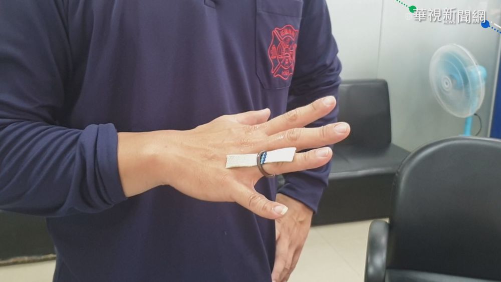 戒指卡手指 女子深夜急奔消防局求助
