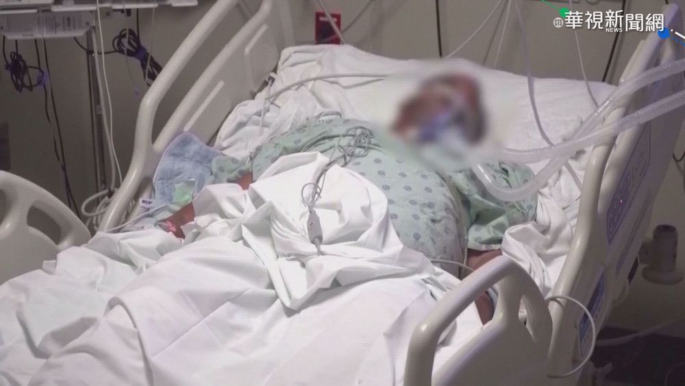 印度變種狂燒! 美國突破性感染增加