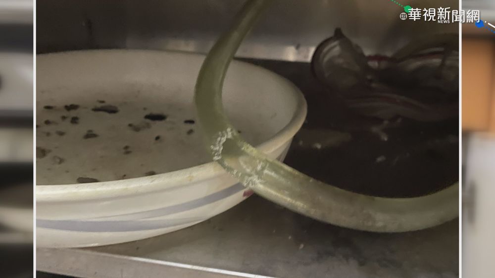 煮飯瓦斯爐突氣爆 婦速閃仍遭燒燙傷