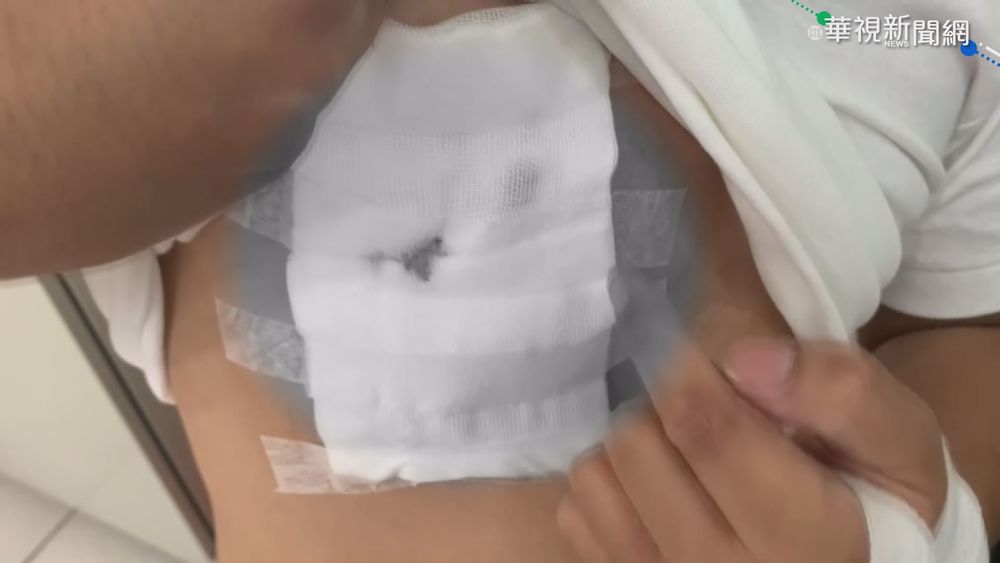 毒犯持美工刀搶超商 店員反抗遭割傷