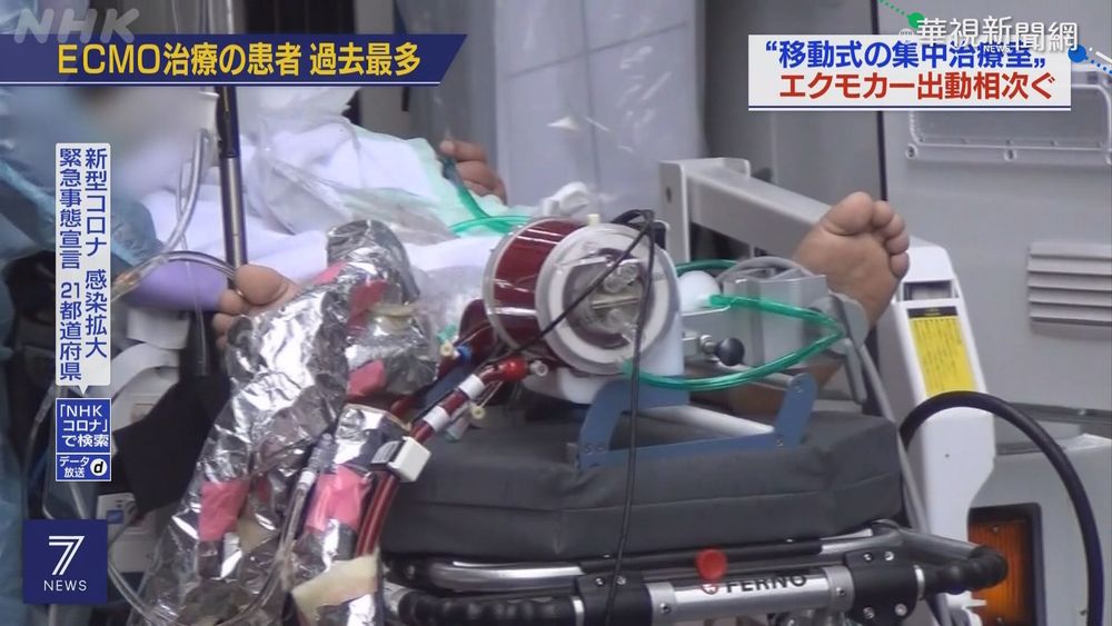 日確診者轉重症 "移動葉克膜車"出動