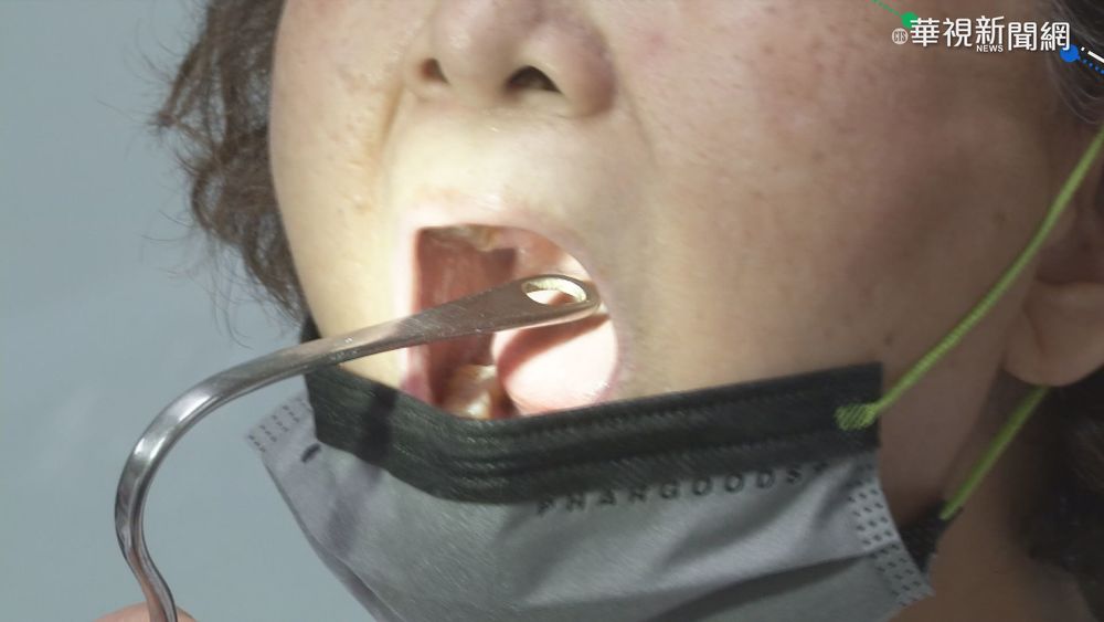 魚刺卡喉就醫門診轉急診 惹患者不滿