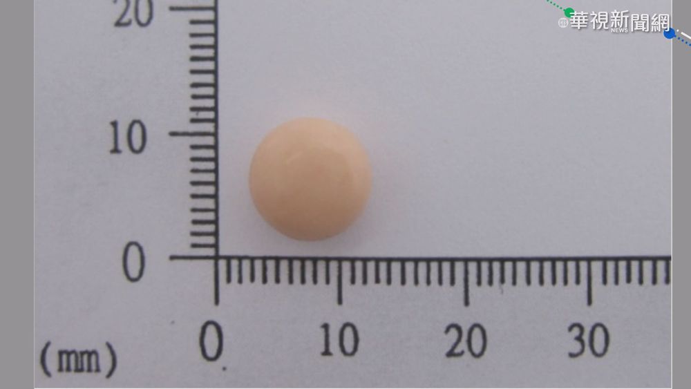 重症肌無力藥"美定隆" 3800萬顆不合格