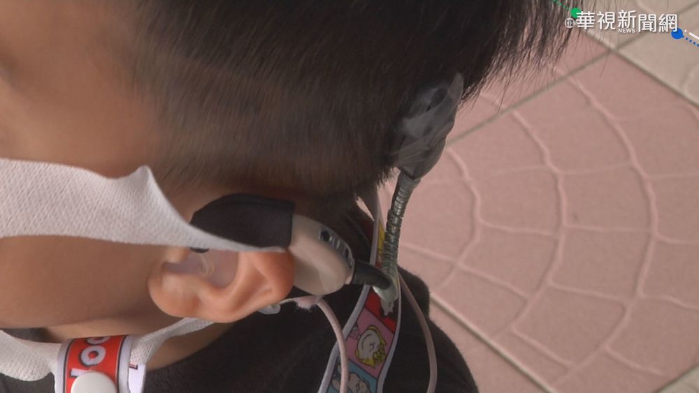 聽障童電子耳需80萬 育幼院盼外界伸援