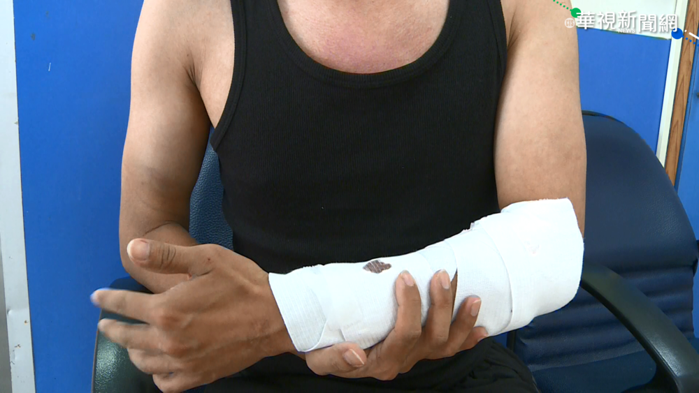 轎車失控衝撞 勇夫肉身護妻雙雙撞飛