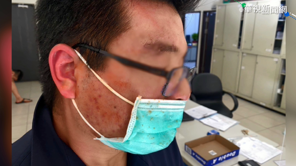 2肇事男鬧事 毆警.救護員還噴辣椒水