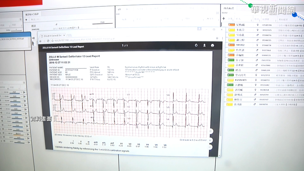 防打BNT心肌炎 柯P擬推心電圖篩檢