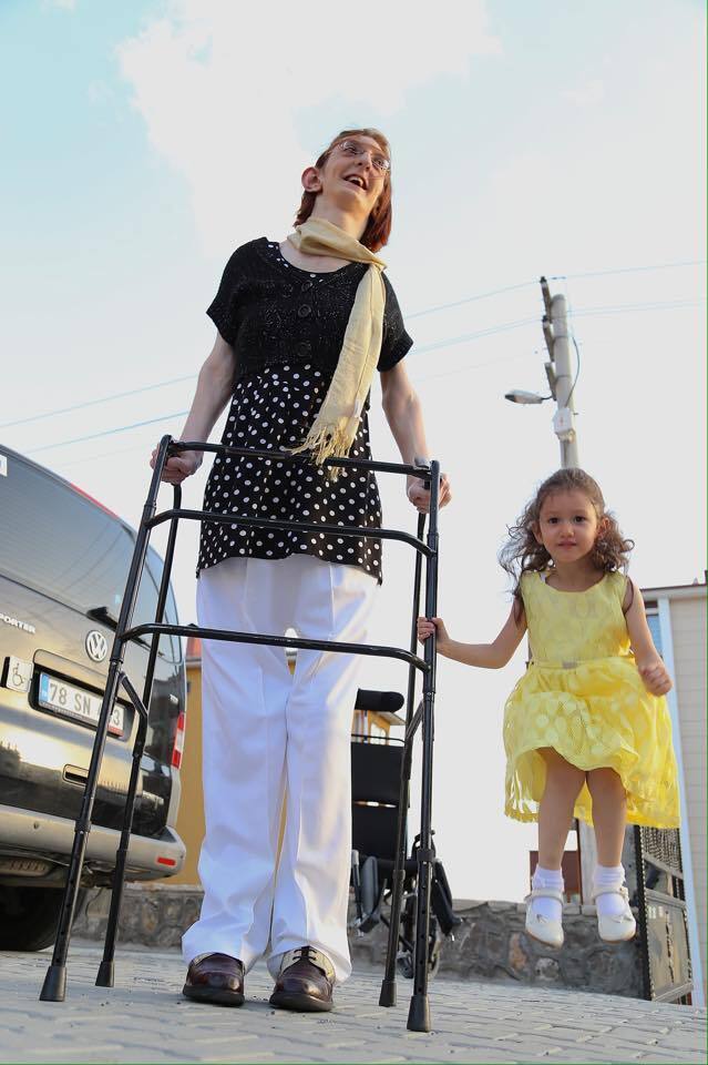 世界最高女215公分 她樂觀回:將劣勢轉為優勢