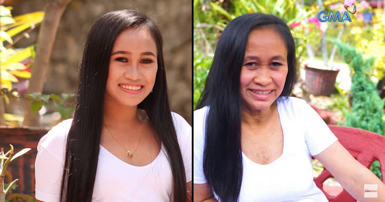 少女超齡面貌參選美 兩年後臉竟佈滿皺紋