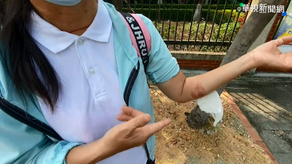 派遣工遭蜂螫恐截肢 竟遭公司踢出群組