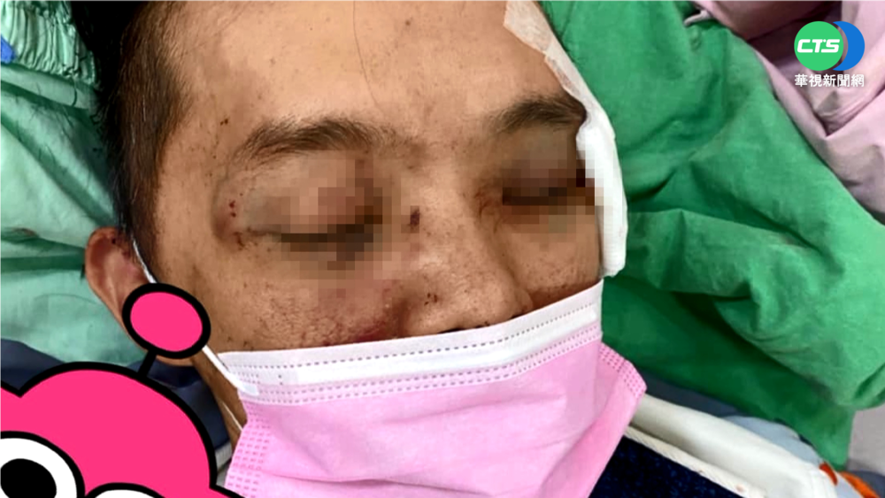 台中超商店員勸客戴罩 遭毆斷6根肋骨