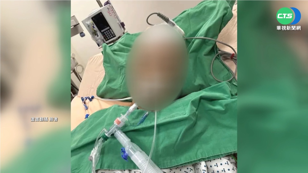 7旬婦跑道散步 遭學生練跑衝刺撞昏迷