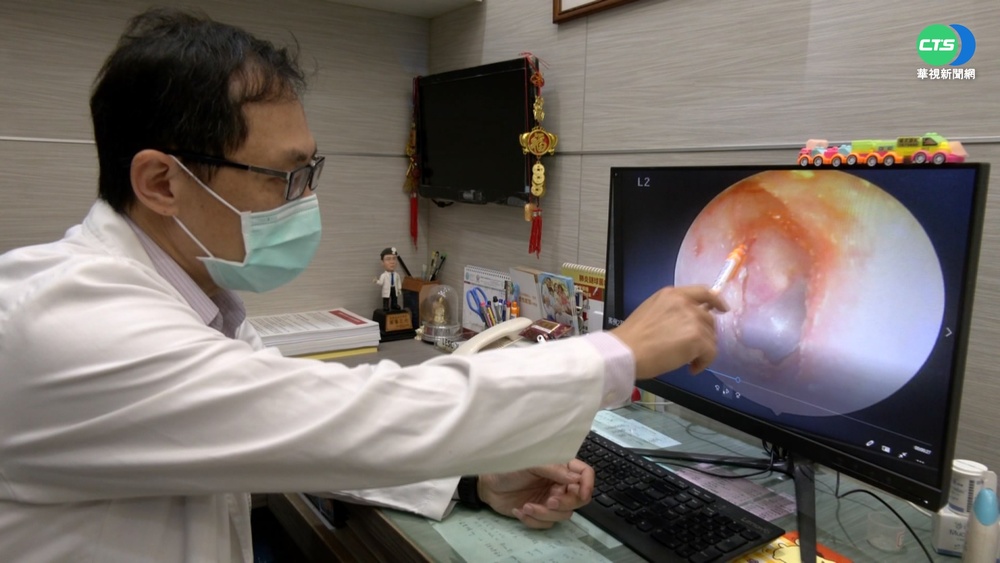 當心"游泳耳"! 男大生棉花棒掏耳突耳聾