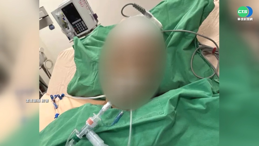 7旬婦跑道散步 遭學生練跑衝刺撞昏迷