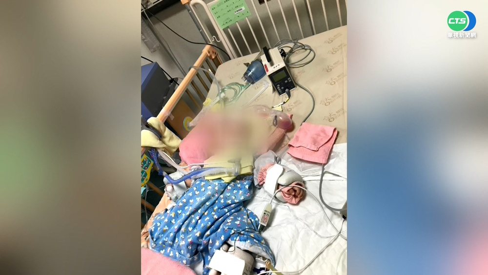 11月男嬰摔出顱內出血 父母控保母虐嬰