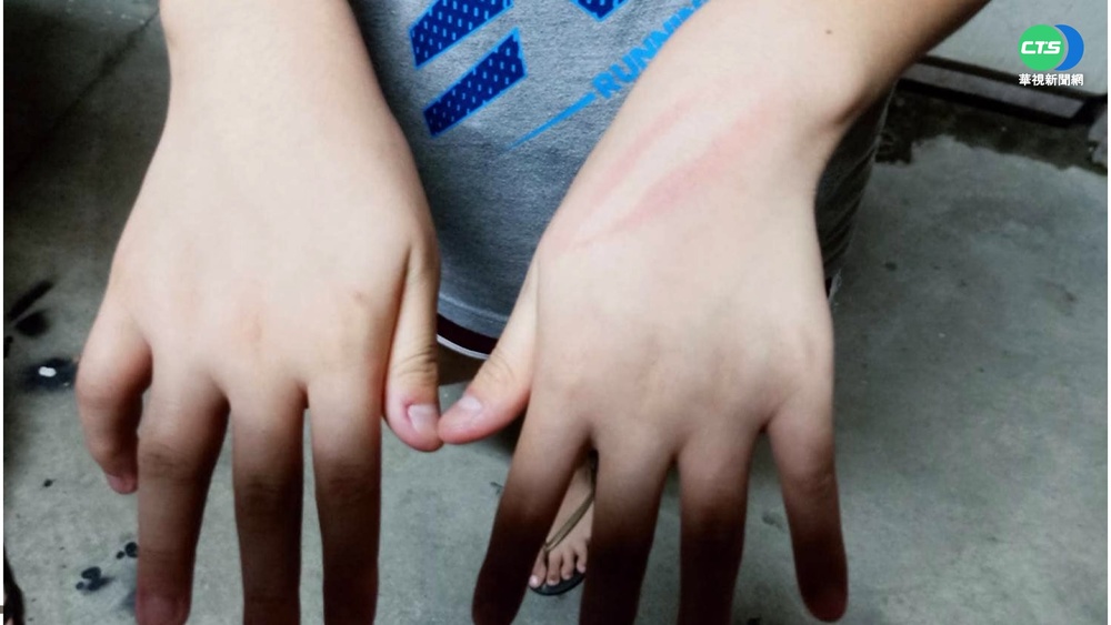控補習班老師藤條打傷學童 家長怒告