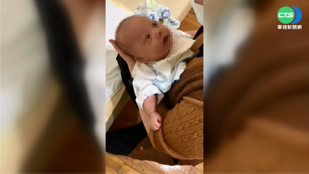 雙胞胎1個無心跳... 緊急"環紮"保住另1個