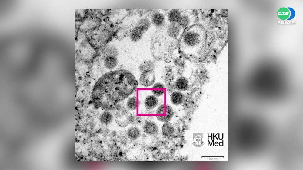 Omicron驚見"隱形版"! 一般PCR難驗出