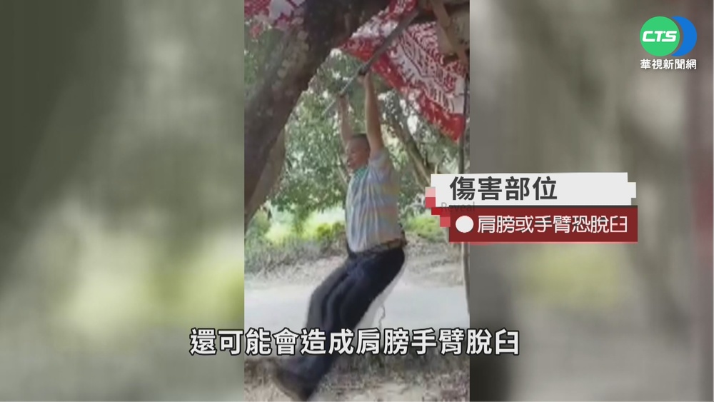 拉單槓舒緩"坐骨神經痛"? 醫:恐導致受傷