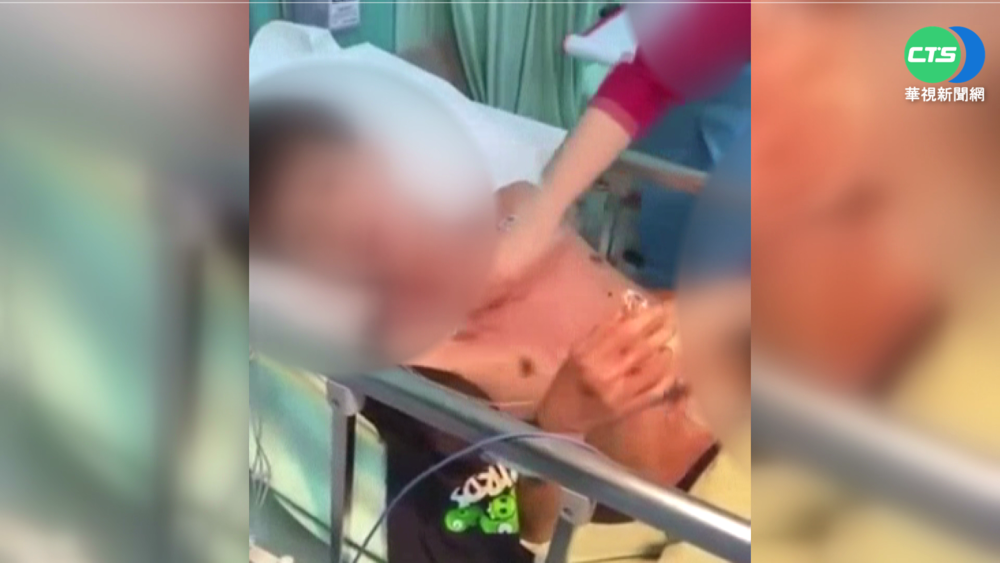 誇張! 身障少年竟遭四男持球棒圍毆