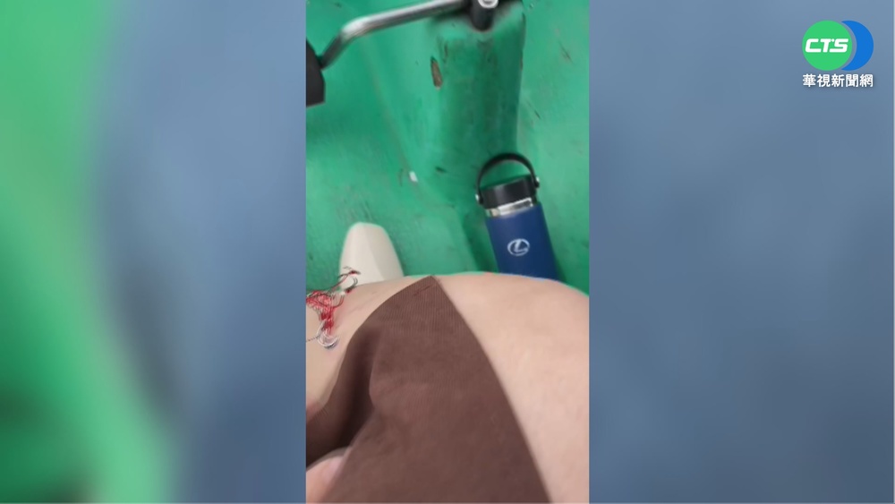 情侶碧潭踩天鵝船 女小腿被"鉤"滲血