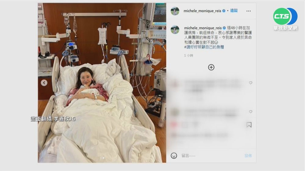 51歲"最美港姐"李嘉欣 ICU搶命48小時