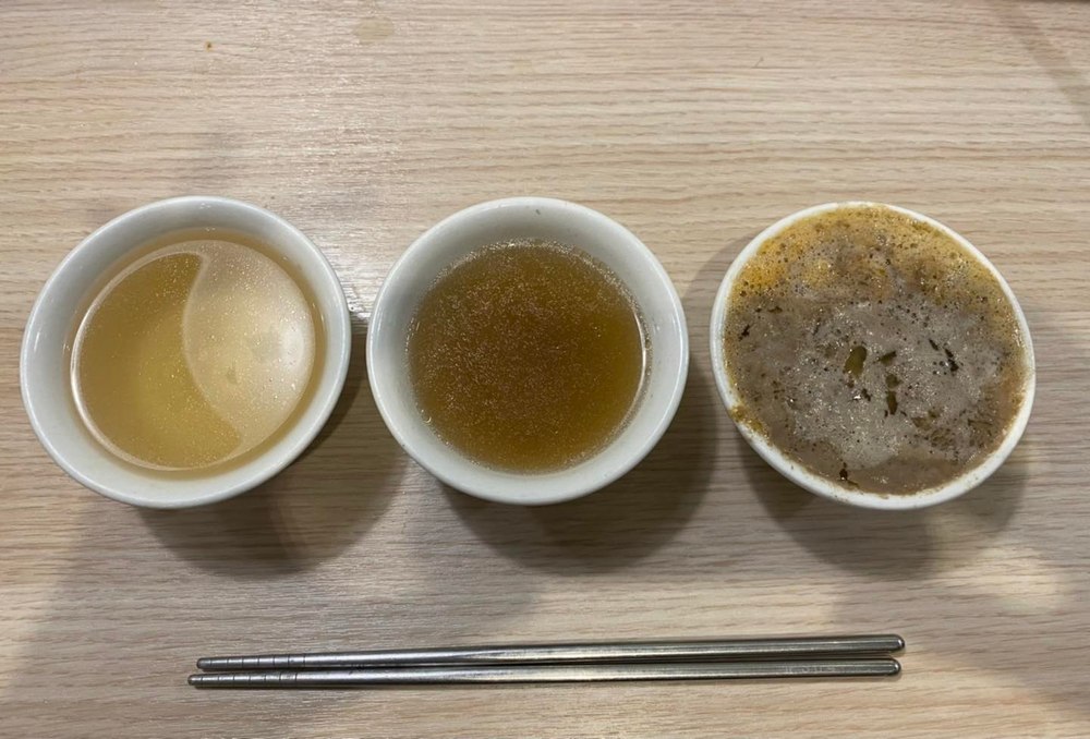 天冷好想吃鍋！減重醫PO鍋底油花照：湯真的別喝