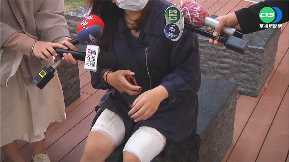 店員上菜不慎 女遭300℃鐵盤燙大腿