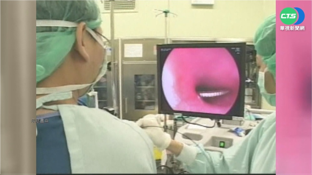 誤吞"壹圓紅包" 2歲童險窒息搶救