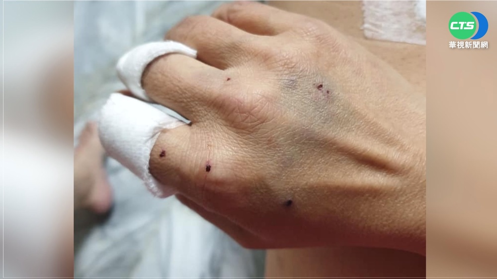 女物流士送件遭惡犬咬 囂張飼主還嗆聲