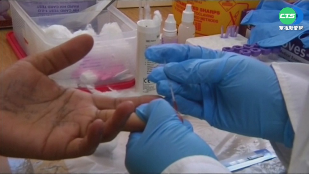 愛滋病治療新曙光 全球首例女性治癒