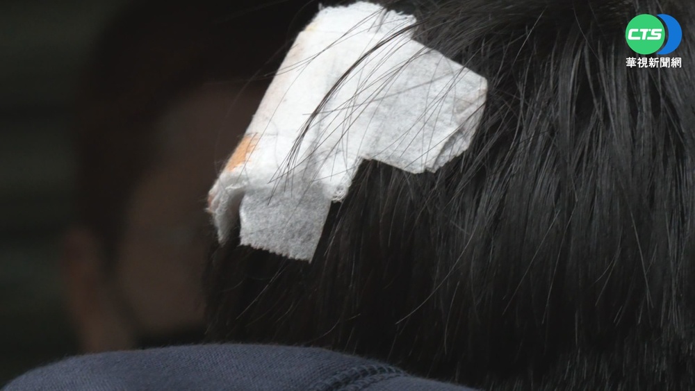 國中生欠同學400元不還 竟撂人砸破頭