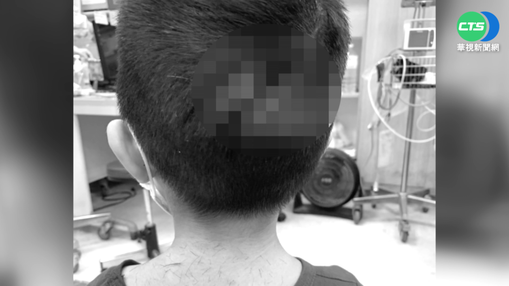 "額頭破洞"滿臉鮮血 繼父無情施暴4童