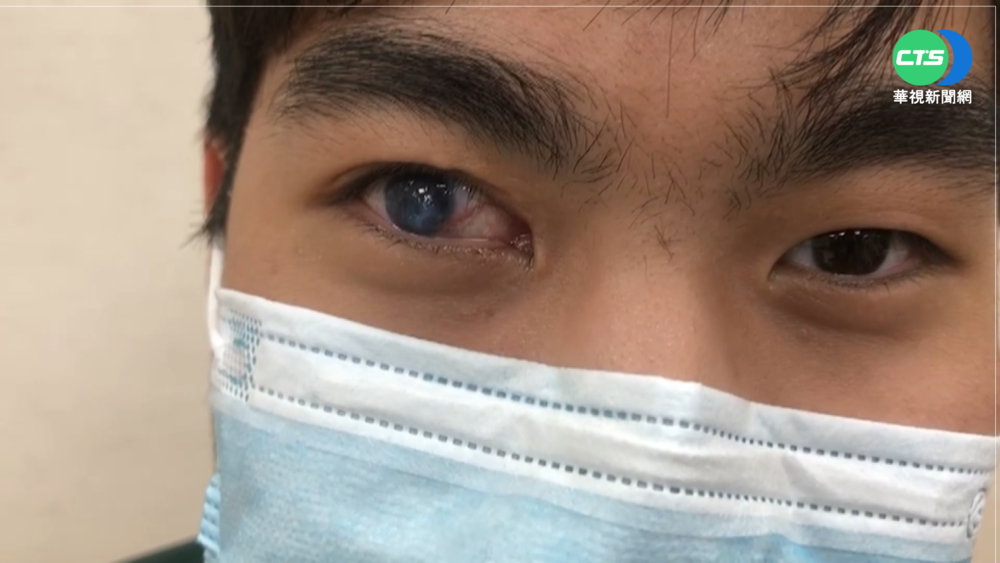 少年遭鋼筋插眼 中市府只願賠20萬還上訴