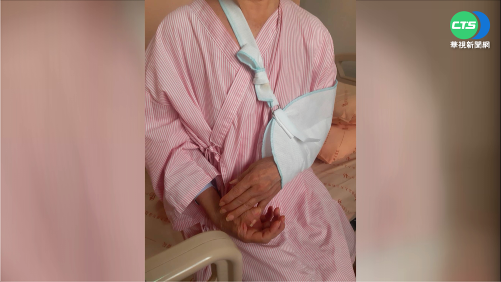 閃避車輛急煞未碰撞 婦竟左手肱骨骨折