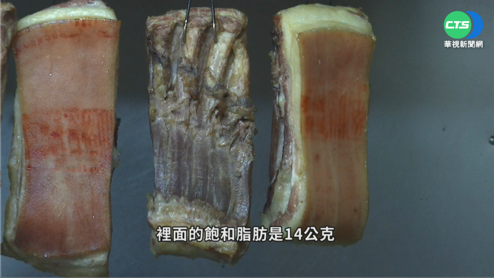 吃豬皮軟化血管抗三高? 醫:無稽之談