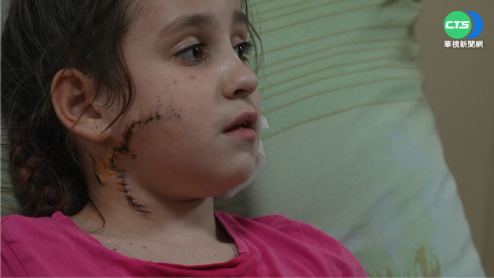 俄無情轟炸 11歲烏女童逃難遇襲身心受創